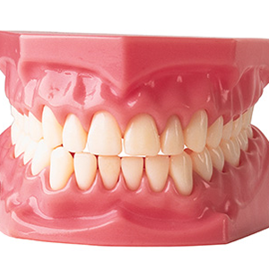 Dentures before and after