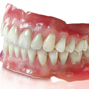 Denture implants